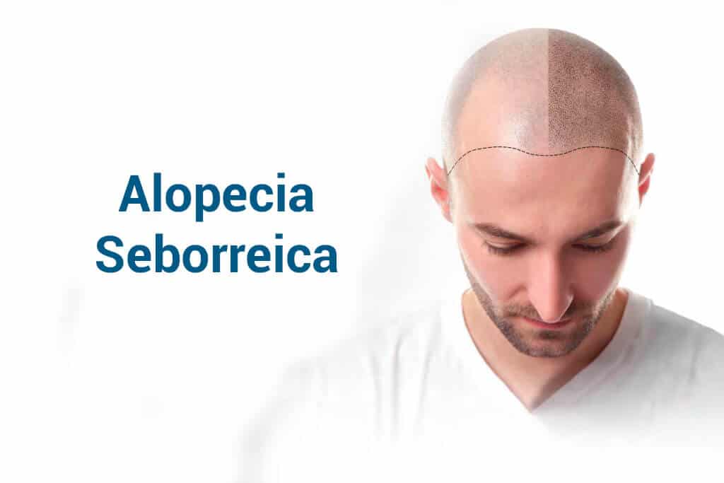 Alopécia sub-rectal